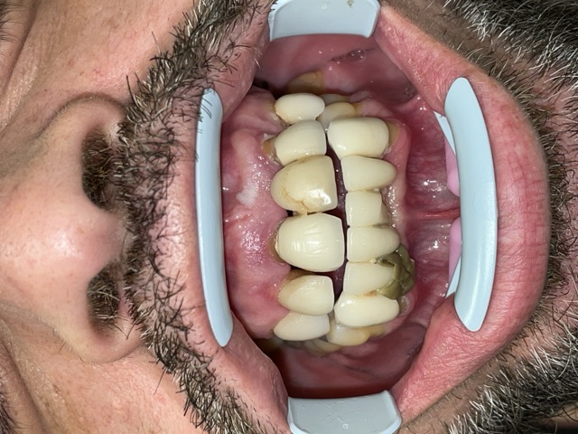 Mohammed A. before treatment