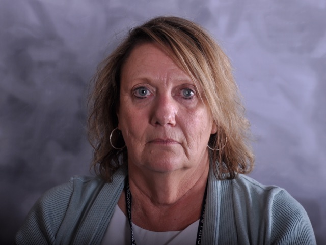 Debra D. before treatment