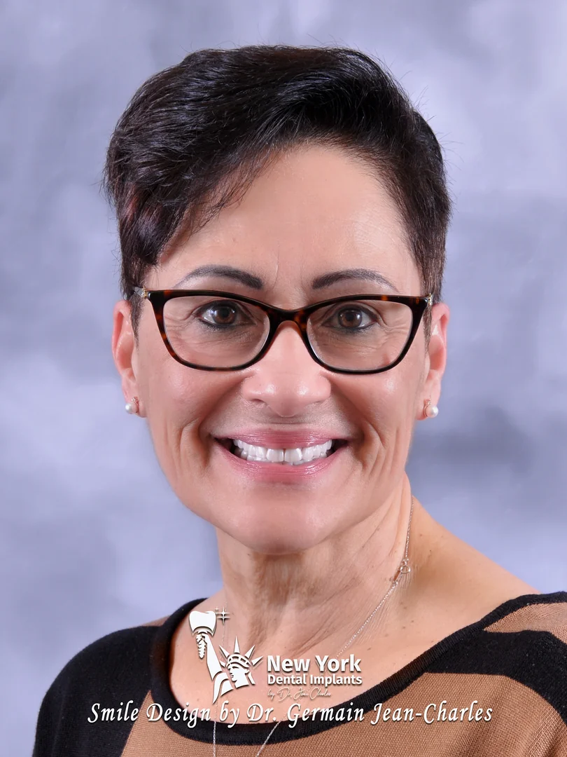 Nilda A. after full arch restoration treatment at New York Dental Implants