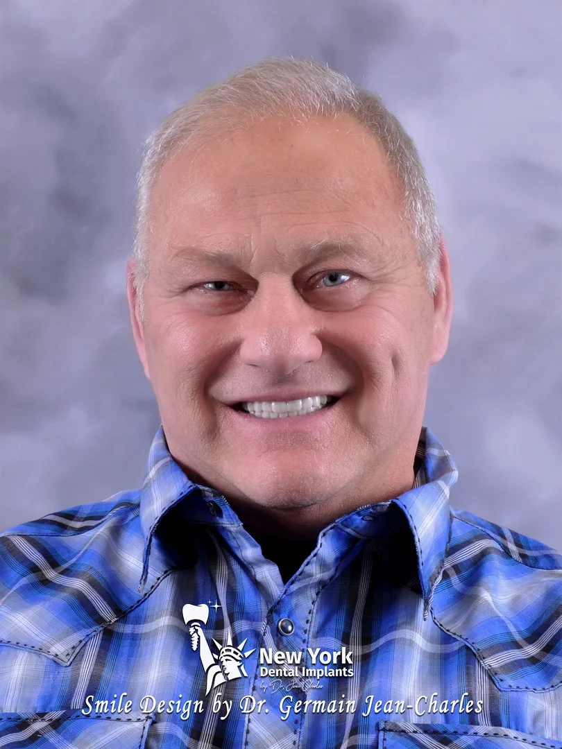 Peter B. after smile makeover treatment at New York Dental Implants