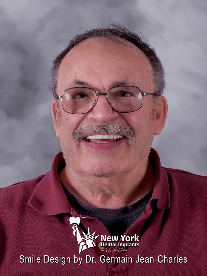 David B. after full arch restoration treatment at New York Dental Implants