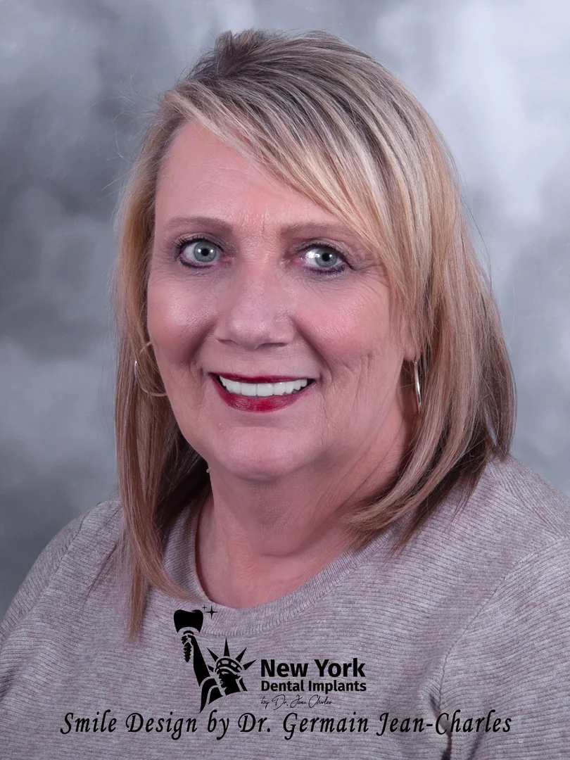 Debra D. after smile makeover treatment at New York Dental Implants