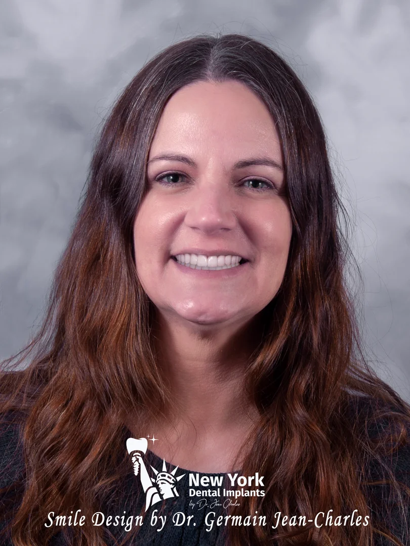 Jennifer E. after smile makeover treatment at New York Dental Implants