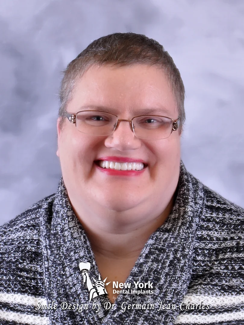 Angel L. after multiple implants treatment at New York Dental Implants