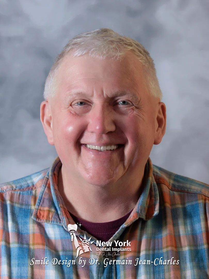 Bradley S. after complete restoration treatment at New York Dental Implants